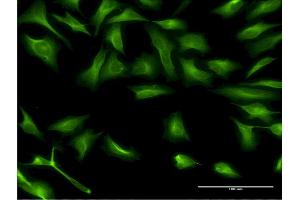 Immunofluorescence of monoclonal antibody to DCP1A on HeLa cell. (DCP1A Antikörper  (AA 186-285))