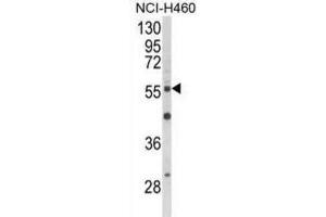 Western Blotting (WB) image for anti-V-Akt Murine Thymoma Viral Oncogene Homolog 2 (AKT2) antibody (ABIN3002945) (AKT2 Antikörper)