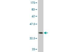 Western Blot detection against Immunogen (36. (ZNF138 Antikörper  (AA 151-251))