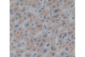 Used in DAB staining on fromalin fixed paraffin- embedded liver tissue (AADAT Antikörper  (AA 202-425))