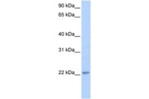 Western Blotting (WB) image for anti-Transcription Elongation Factor A (SII)-Like 2 (TCEAL2) antibody (ABIN2463367) (TCEAL2 Antikörper)