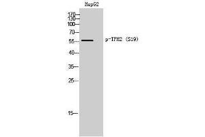 Western Blotting (WB) image for anti-Tryptophan Hydroxylase 2 (TPH2) (pSer19) antibody (ABIN3182390) (Tryptophan Hydroxylase 2 Antikörper  (pSer19))