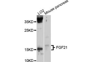 Western blot analysis of extracts of various cell lines, using FGF21 antibody. (FGF21 Antikörper)