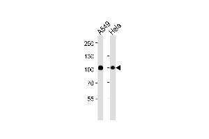 Western blot analysis of lysates from A549,Hela cell line (from left to right),using Uba2 Antibody (ABIN484072 and ABIN1533453). (UBA2 Antikörper)