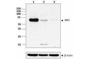 Western Blotting (WB) image for anti-Interferon Regulatory Factor 5 (IRF5) antibody (ABIN2666392) (IRF5 Antikörper)
