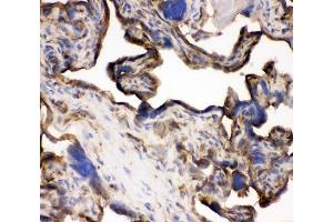 IHC analysis of TFRC using anti-TFRC antibody (ABIN3043538). (Transferrin Receptor Antikörper  (AA 1-198))