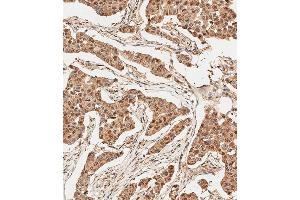 Immunohistochemistry (Paraffin-embedded Sections) (IHC (p)) image for anti-Ubiquitin (Ub) (AA 1-32), (N-Term) antibody (ABIN388039)