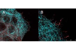 Immunofluorescence (IF) image for anti-V-Akt Murine Thymoma Viral Oncogene Homolog 1 (AKT1) (Ser473) antibody (ABIN400784)