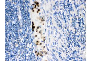Immunohistochemistry (IHC) image for anti-Fatty Acid Binding Protein 3, Muscle and Heart (FABP3) (AA 119-133), (C-Term) antibody (ABIN3042627)
