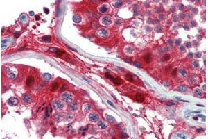 Human Testis (formalin-fixed, paraffin-embedded) stained with GATA3 antibody ABIN462169 followed by biotinylated goat anti-rabbit IgG secondary antibody ABIN481713, alkaline phosphatase-streptavidin and chromogen. (GATA3 Antikörper  (AA 36-85))