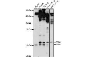 Western blot analysis of extracts of various cell lines, using EREG antibody (ABIN7266994) at 1:1000 dilution. (Epiregulin Antikörper  (C-Term))