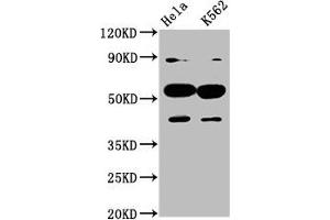 Western Blotting (WB) image for anti-Cytochrome P450, Family 7, Subfamily A, Polypeptide 1 (CYP7A1) (AA 303-423) antibody (ABIN7147604)