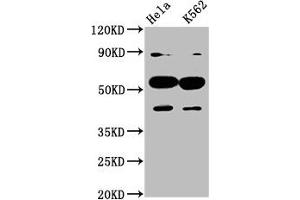 Western Blot Positive WB detected in: Hela whole cell lysate, K562 whole cell lysate All lanes: CYP7A1 antibody at 4. (CYP7A1 Antikörper  (AA 303-423))