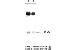 Image no. 1 for anti-Prostaglandin D2 Synthase (PTGDS) antibody (ABIN2451689) (PTGDS Antikörper)