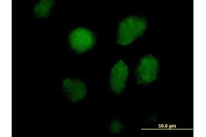 Immunofluorescence of purified MaxPab antibody to TAF5L on HeLa cell.