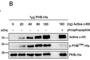 Western Blotting (WB) image for anti-Prohibitin (PHB) antibody (ABIN2854938)
