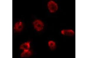 ABIN6275688 staining Hela by IF/ICC. (ZC3H8 Antikörper  (Internal Region))