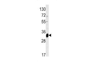 Western blot analysis of ELOVL6 antibody (N-term) (ABIN390425 and ABIN2840812) in mouse liver tissue lysates (35 μg/lane). (ELOVL6 Antikörper  (N-Term))