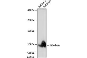 Western blot analysis of extracts of various cell lines, using S100 beta antibody (ABIN7270131) at 1:1000 dilution.