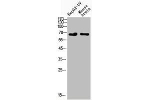 Western Blot analysis of HepG2-UVmouse brain cells using Acetyl-NFκB-p65 (K122) Polyclonal Antibody