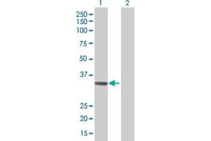 Western Blot analysis of ADAMTS4 expression in transfected 293T cell line by ADAMTS4 MaxPab polyclonal antibody. (ADAMTS4 Antikörper  (AA 1-339))