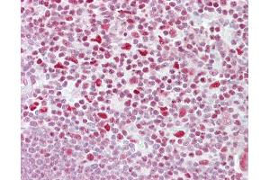 Anti-NFATC3 antibody IHC of human thymus. (NFATC3 Antikörper  (AA 324-373))