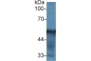 Detection of CYP2D6 in Rat Liver lysate using Polyclonal Antibody to Cytochrome P450 2D6 (CYP2D6) (CYP2D6 Antikörper  (AA 236-472))