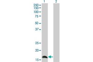 Western Blot analysis of IFNA2 expression in transfected 293T cell line by IFNA2 monoclonal antibody (M36), clone 2C10. (IFNA2 Antikörper  (AA 24-188))