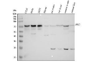 Western blot analysis of PRC1 using anti-PRC1 antibody (ABIN3043445). (PRC1 Antikörper  (AA 1-233))
