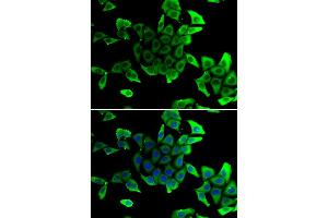 Immunofluorescence analysis of U2OS cells using SGCD antibody. (SGCD Antikörper)