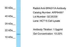 Western Blotting (WB) image for anti-Sperm Associated Antigen 11A (SPAG11A) (N-Term) antibody (ABIN971765) (SPAG11A Antikörper  (N-Term))