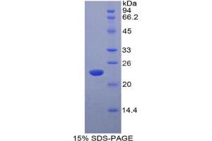 SDS-PAGE analysis of Rat Interferon alpha 5 Protein. (IFNA5 Protein)