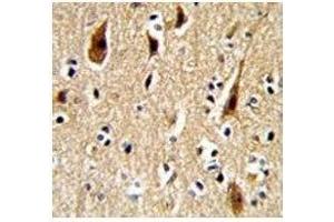 IHC analysis of FFPE human brain with APP antibody (APP Antikörper  (AA 29-61))