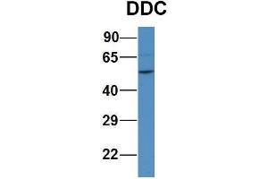 WB Suggested Anti-DDC Antibody Titration:  1ug/ml  Positive Control:  Human 293T cell lysate (DDC Antikörper  (N-Term))