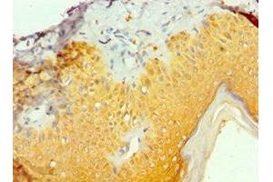 Immunohistochemistry (IHC) image for anti-TIA1 Cytotoxic Granule-Associated RNA Binding Protein (TIA1) (AA 1-193) antibody (ABIN7161993)