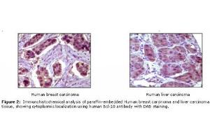 Image no. 1 for anti-B-Cell CLL/lymphoma 10 (BCL10) antibody (ABIN207592) (BCL10 Antikörper)