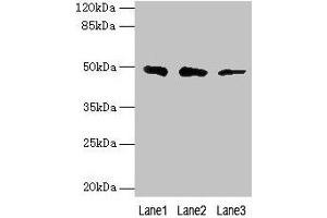 Western blot All lanes: ZBTB6 antibody at 8 μg/mL Lane 1: Hela whole cell lysate Lane 2: HepG2 whole cell lysate Lane 3: 293T whole cell lysate Secondary Goat polyclonal to rabbit IgG at 1/10000 dilution Predicted band size: 49 kDa Observed band size: 49 kDa