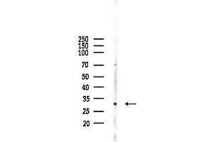 anti-Ribosomal Protein L7a (RPL7A) (N-Term) antibody