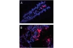 Immunofluorescence (IF) image for anti-S100 Calcium Binding Protein A8/A9 (S100A8/A9) antibody (ABIN953503) (S100A8/A9 Complex (Calprotectin) Antikörper)