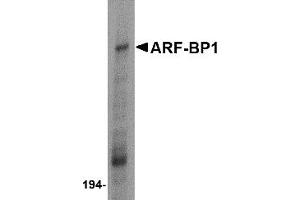 Western Blotting (WB) image for anti-HECT, UBA and WWE Domain Containing 1, E3 Ubiquitin Protein Ligase (HUWE1) (C-Term) antibody (ABIN1030253) (HUWE1 Antikörper  (C-Term))