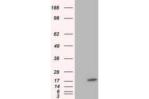 HEK293T cells were transfected with the pCMV6-ENTRY control (Left lane) or pCMV6-ENTRY TTC32 (Right lane) cDNA for 48 hrs and lysed. (TTC32 Antikörper)