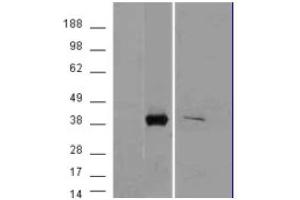 Image no. 2 for anti-Aldo-Keto Reductase Family 1, Member B10 (Aldose Reductase) (AKR1B10) (C-Term) antibody (ABIN374920) (AKR1B10 Antikörper  (C-Term))