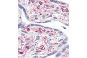 Immunohistochemical analysis of formalin-fixed and paraffin-embedded human Placenta tissue reacted with IRAK Antibody (C-term), which was peroxidase-conjugated to the secondary antibody, followed by AEC staining. (IRAK1 Antikörper)
