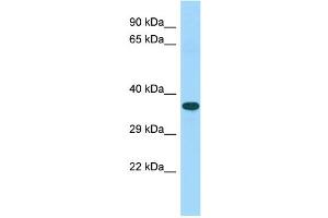 Host: Rabbit Target Name: C15orf52 Sample Type: Fetal Heart lysates Antibody Dilution: 1. (C15ORF52 Antikörper  (C-Term))