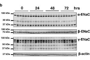 The expression of ENaC subunits after preservation in UW solution. (SCNN1A Antikörper  (AA 617-638))