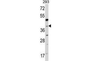 Western blot analysis of NAGK (arrow) in 293 cell line lysates (35ug/lane) using NAGK  Antibody (C-term).