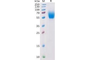 Human IL13RA1  Protein, His Tag on SDS-PAGE under reducing condition. (IL13 Receptor alpha 1 Protein (His tag))
