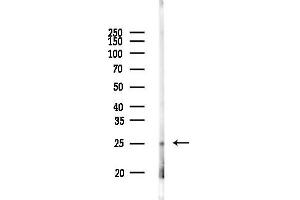 Western blot analysis of lysates from Rat lung, using IL29 Antibody at 1/1000 dilution.