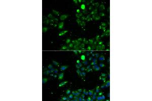 Immunofluorescence analysis of U2OS cells using UQCRFS1 antibody.