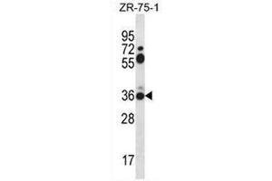 Western blot analysis in ZR-75-1 cell line lysates (35µg/lane) using Syntaxin 2 / STX2 Antibody (Center) Cat.